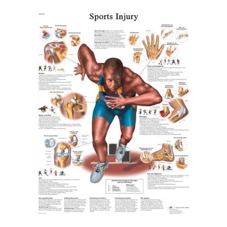 Fabrication Enterprises 3B Anatomical Chart - Sports Injuries, Laminated 12-4623L